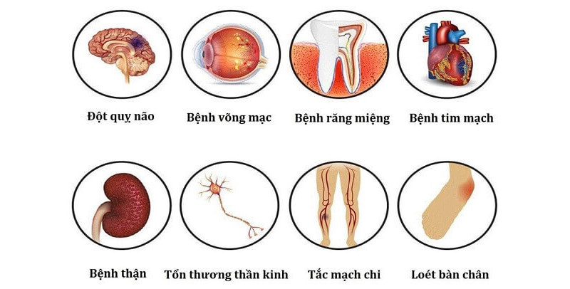 Vì sao bệnh tiểu đường được coi là "kẻ giết người thầm lặng"?