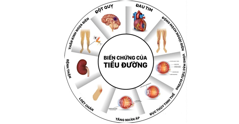 Tiểu đường - Căn bệnh dễ tử vong, khó nhận biết