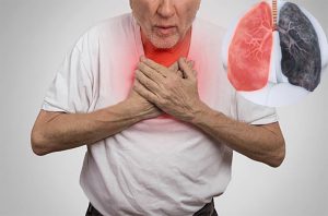 5 triệu chứng điển hình nhất của COPD