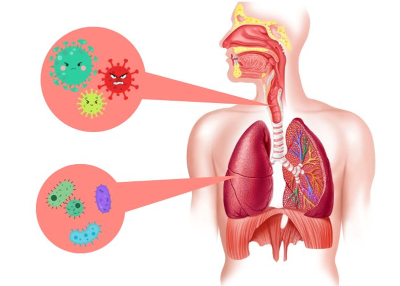 Những lưu ý cần nắm khi điều trị viêm phế quản cấp 