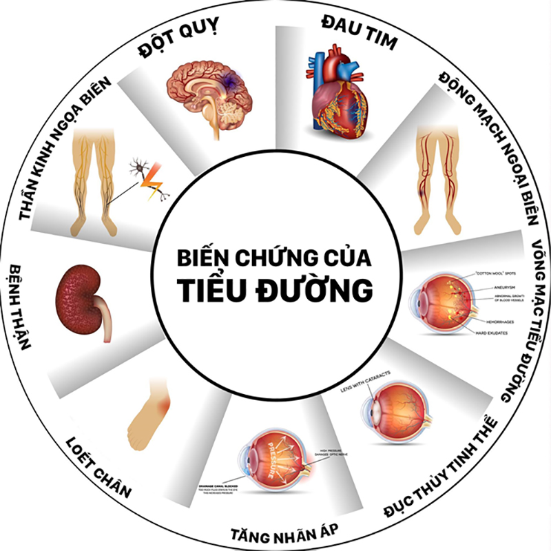 Phòng ngừa biến chứng bệnh tiểu đường tuýp 2