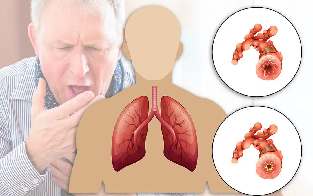 chăm sóc người copd