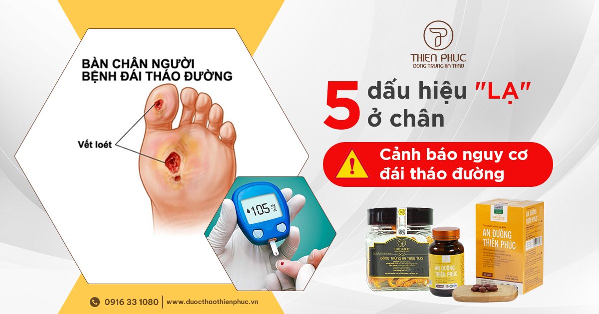 Những dấu hiệu lạ ở bàn chân cảnh báo nguy cơ đái tháo đường